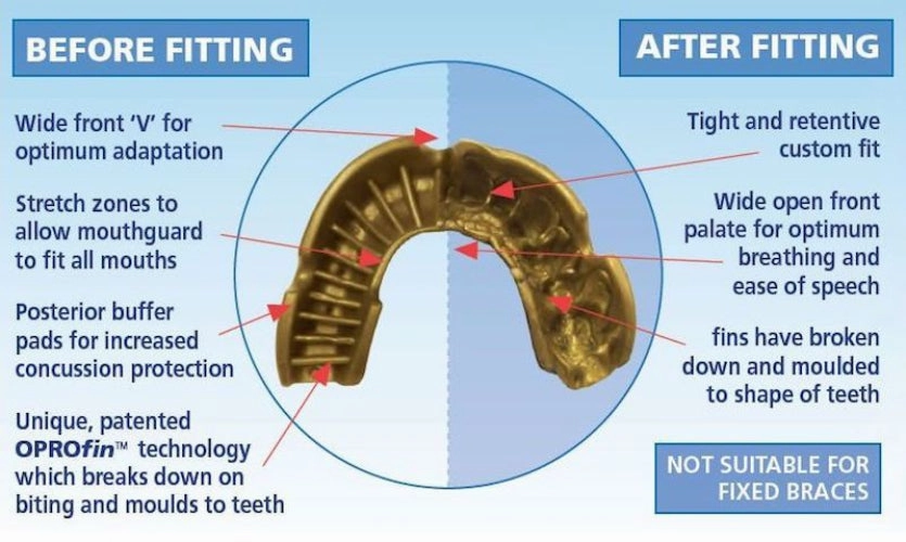 Adidas OPRO Snap-Fit MouthGuard Gum Shield